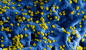 Nieuw coronavirus (COVID-19) RIVM